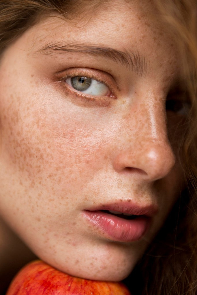 Dlaczego najczęściej mamy problem ze skórą naczyniową na twarzy? I czemu u niektórych osób występuje, a u niektórych nie?